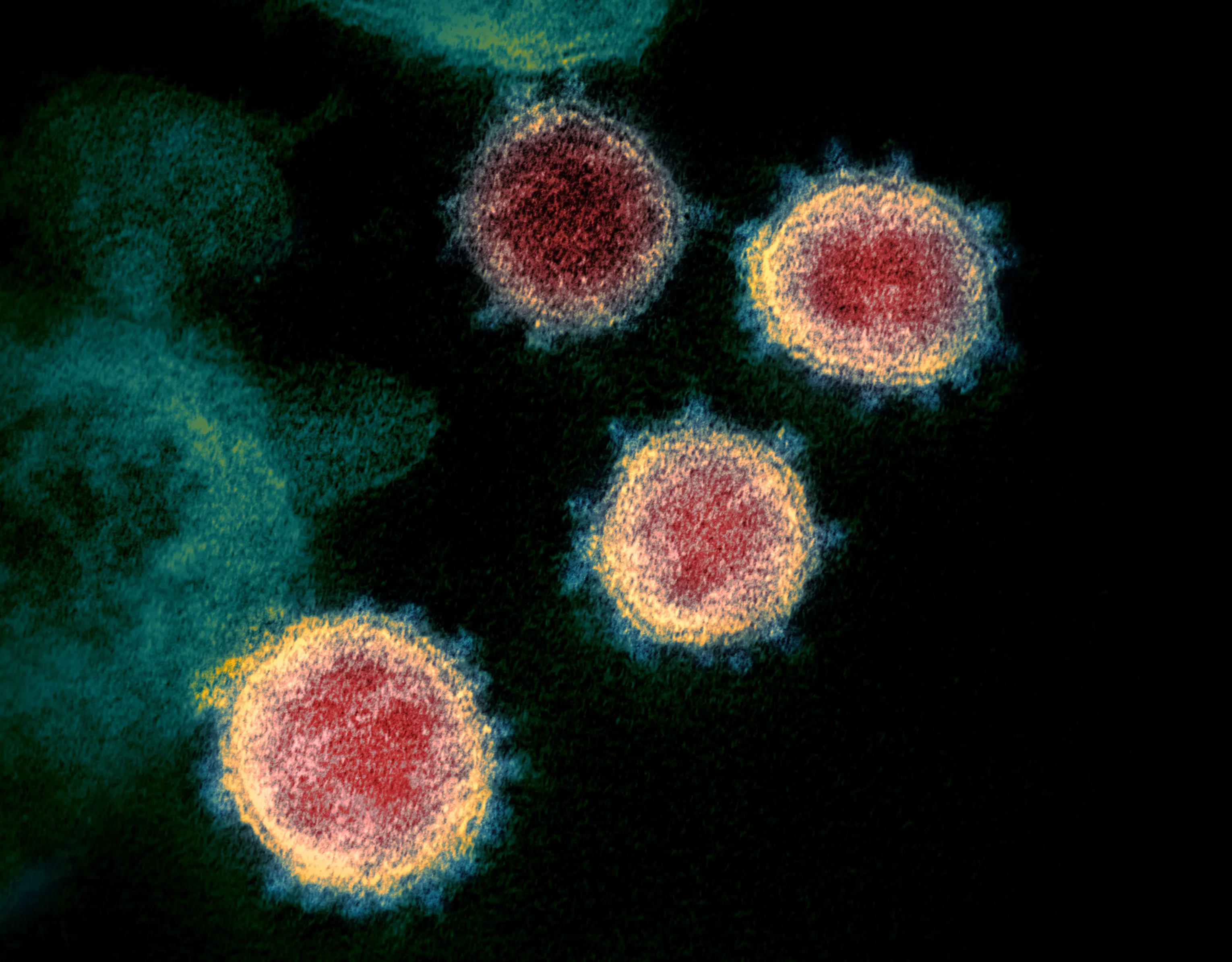 Colorized microscopy image of round virus particles with red cores and yellow-blue spiked surfaces on a dark background, creating a serious scientific news mood